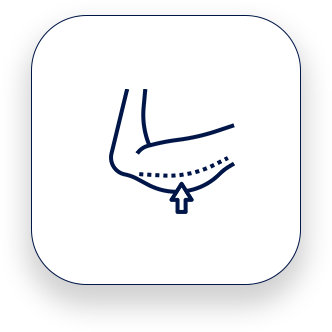 Remodelar a região dos braços, removendo o excesso de pele e gordura para restaurar a firmeza e proporcionar uma aparência mais tonificada.