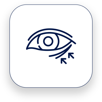 Ilumine seu olhar, rejuvenescendo a região dos olhos.